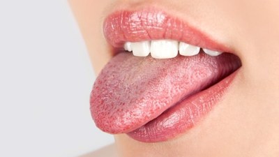 Dilinizin rengi sinyal veriyor: Bu değişimler kanser veya diyabet belirtisini gösteriyor olabilir…