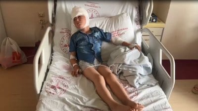 Mardin'de küçük çocuk komşusunun saldığı köpeğin saldırısına uğradığı