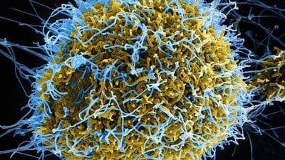 Çinli bilim insanları ağır semptomları olan mutant Ebola virüsü üretti