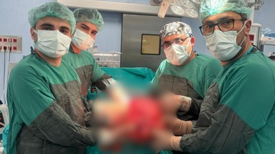 Gaziantep'te karın ağrısıyla doktora giden kadının böbreğinde 35 cm kitle çıktı