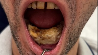İstanbul'da dişçiye giden hasta diş hekimini şoke etti