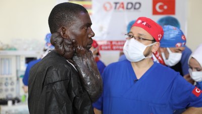 Ugandalı Muhammed'i, yüzündeki 5 kiloluk kitleden Türk doktorlar kurtardı