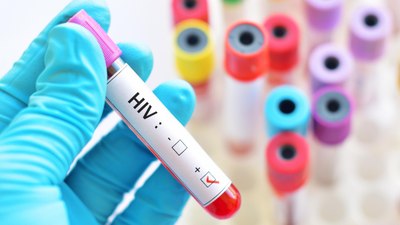 HIV enfeksiyonlarını neredeyse yüzde 100 önleyebilen bir ilaç bulundu