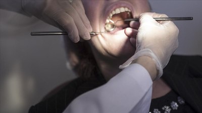 Diyarbakır'da diş çekiminden sonra kanaması durmayan çocuk öldü