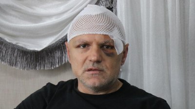 Sakarya'da öldüresiye dövülen tekel bayi işletmecisi: Ölümü bekledim