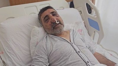 İstanbul'da İngiliz boksörün darbettiği taksici konuştu