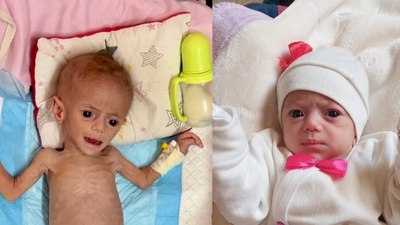 Gazze’de beş aylık Suvar Aşur, yetersiz beslenme yüzünden ölümle burun buruna