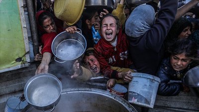 Gazze'de binlerce çocuk açlıktan ölebilir