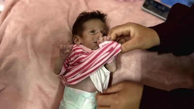 Gazze'de bir bebek daha açlık yüzünden can vermek üzere