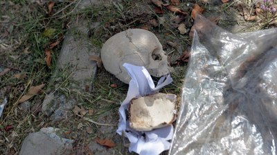 Adana'da çöpte kafatası bulundu: Uzman doktorun temizlik yapan eşi atmış