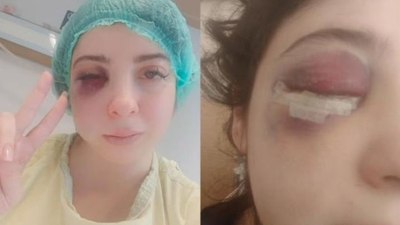 Samsun'da sokak ortasında darbedilen Damla: Platinler hep yüzümde kalacakmış