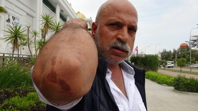Antalya'da 3 kişi tarafından 'husumetlinin selamı var' denilerek darbedildi