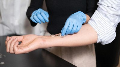 Enfeksiyonu günler öncesinden tespit eden akıllı bandaj çıktı