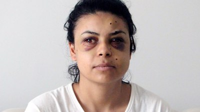 Kırklareli'de maganda pencereden Nazar'ı yaraladı