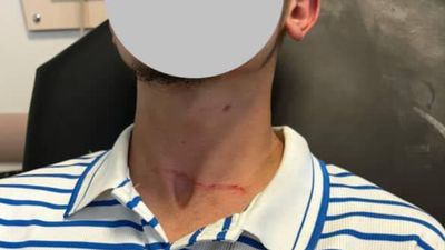 Kastamonu'da motosikletli kurye başıboş köpeğin saldırısına uğradı