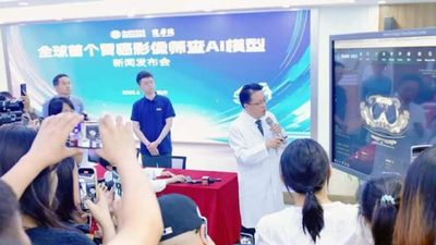 Alibaba'nın yeni yapay zekası mide kanserini erken evrelerde tespit edebiliyor