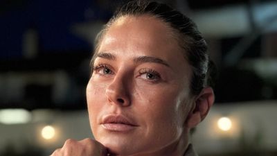 Ece Uslu tatilde hastanelik oldu! 16 dikiş atıldı