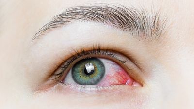 Gözyaşı üretiminin artması hastalıkların habercisi olabilir