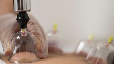 Ağustos 2025 hacamat günleri: Hangi günler hacamat sünnettir