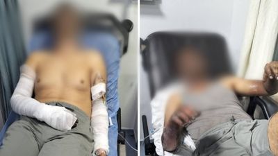 Manisa'da oto tamirhanesinde patlama: 2 kişi ölümden döndü