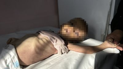 Gazze'de son 24 saatte 11 kişi açlıktan hayatını kaybetti