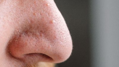 Burun kıllarını asla kökten almayın: Hayati tehlike oluşturuyor