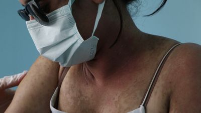 Van'da internetten aldığı krem hastanelik etti