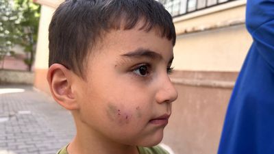 Ankara'da evde uyuyan çocuğu lağım faresi ısırdı