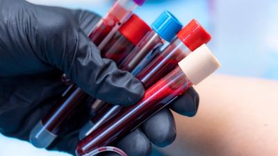 Acı onlara işlemiyor! İşte acı eşiği yüksek olan kan grubu