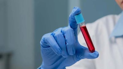 Uzmanlar açıkladı: 0, A, B, AB kan grubu nasıl beslenmeli? İşte, uzak durulması gerekenler