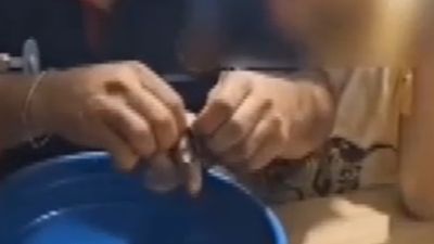 Mardin’de çocuğun parmağına vida pulu sıkıştı