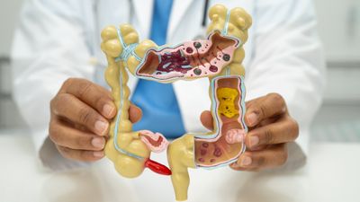 Genç ve orta yaş grubunda sıkça rastlanan gizli tehdit: Apandisit kanseri