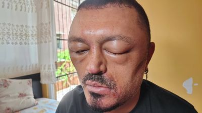 Adana'da saçlarını siyahlaştırmak isteyen adamın başına gelmeyen kalmadı