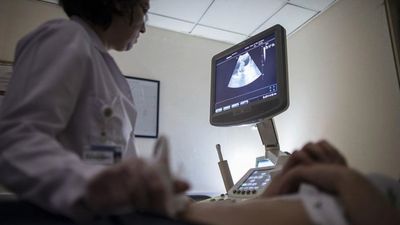 Çikolata kistleri tehlike saçıyor: Dikkate alınmazsa kadınlarda kısırlığa sebep oluyor