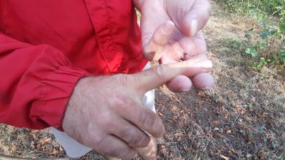 Bolu'da ayının saldırısına uğrayan çiftçi dehşet anlarını anlattı