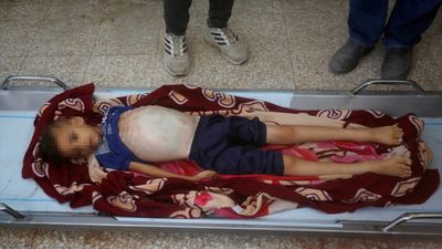 Gazze'de soykırım: 8 yaşındaki çocuk açlıktan hayatını kaybetti