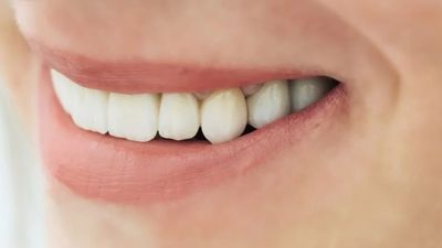 Dişlerinizin rengine dikkat: Meğer o hastalığın habercisiymiş