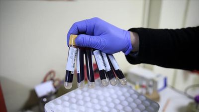 Tüketmeyen pişman olur: Demir eksikliğine iyi gelen 8 besin