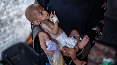 Gazze'de kıtlık: Yetersiz beslenme sonucu can kaybı 453'e yükseldi