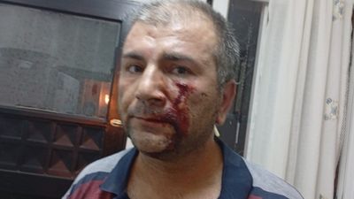 Adana'da 'Kenara çekilir misiniz' diyerek uyardı: Dayak yedi