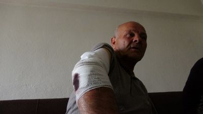 Burdur'da beslemek istediği köpeğin saldırısına uğradı