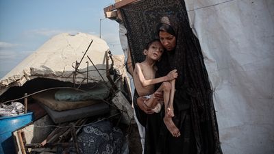 Gazze'de açlıktan ölenlerin sayısı 457'ye yükseldi