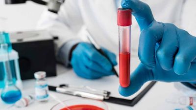 Kansızlığı anlamanın 7 sinyali: Bu belirtiler varsa dikkat