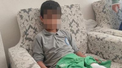 Bursa’da sokak köpeği saldırısı: 8 yaşındaki çocuk yaralandı