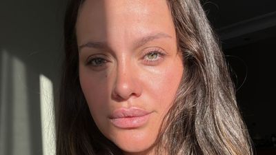 Ünlü oyuncu İrem Helvacıoğlu korkutan kazayı anlattı