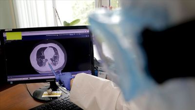 Sağlığı etkileyen sessiz tehdit: Magnezyum eksikliği