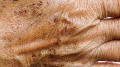 Günde 1 kez sürün, yaşlılık lekelerini götürün...