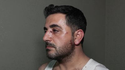 Esenyurt’ta kiracı dehşeti: Ev sahibini bıçakladı