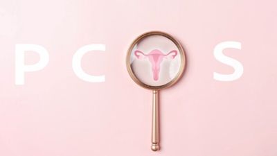 Kadınların en çok yaşadığı ama en az konuştuğu sendrom: PCOS
