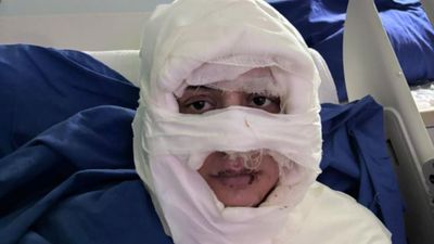 Kadıköy'de genç kadın, başka bir kadın tarafından ateşe verildi